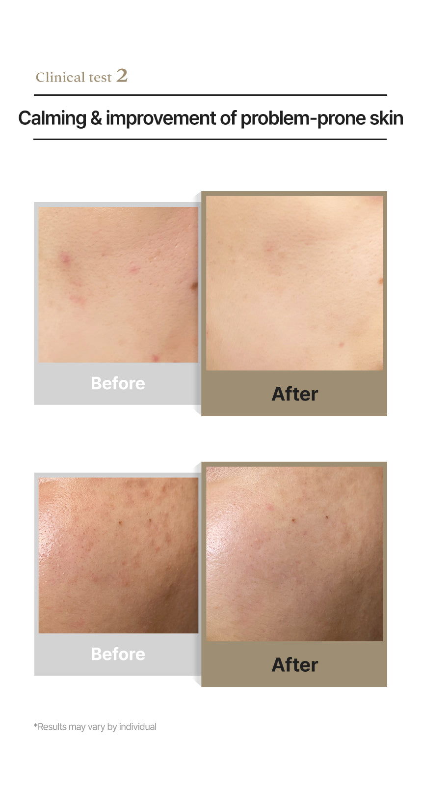 Dermathod Soba Calm Cream